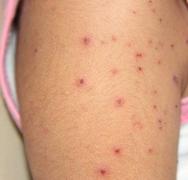 Recomienda la Secretaría de Salud