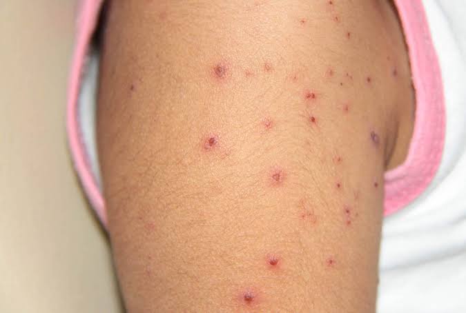 Recomienda la Secretaría de Salud